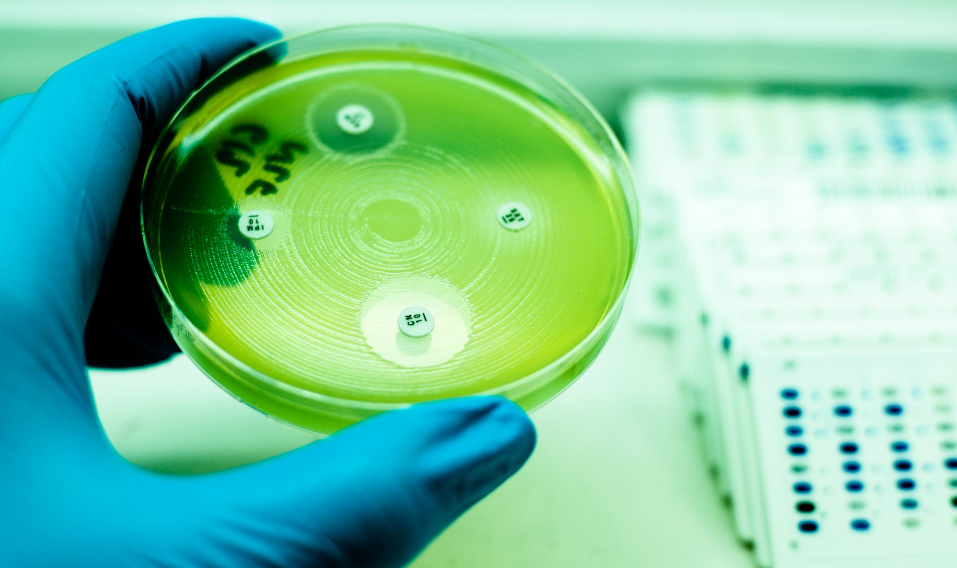 Fungus Testleri